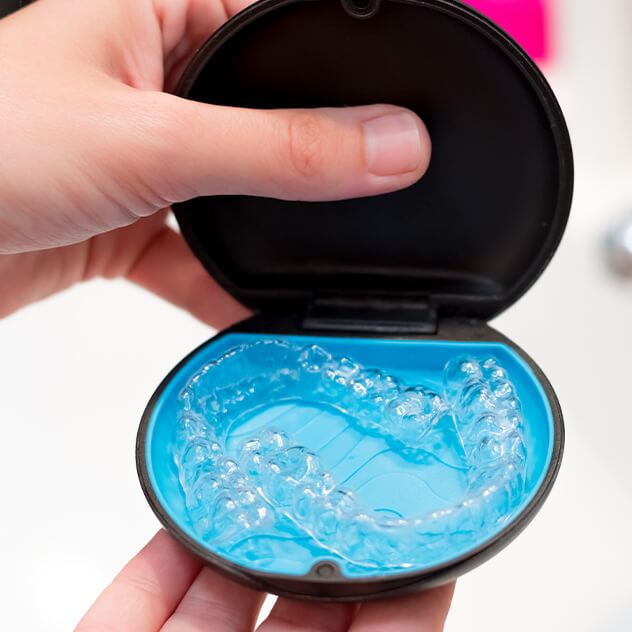 What are clear aligners? 