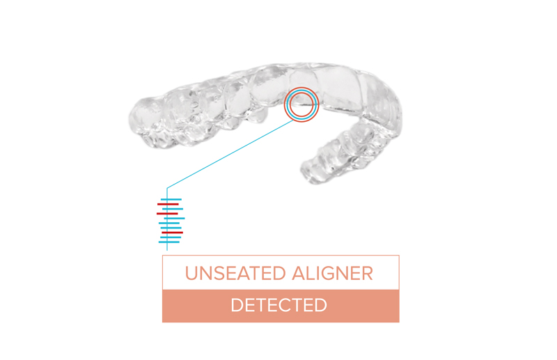 Dental Monitoring