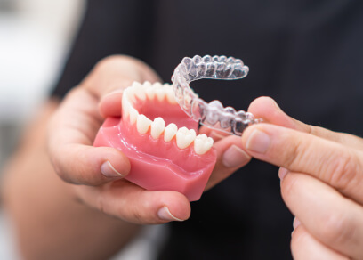 Clear aligners