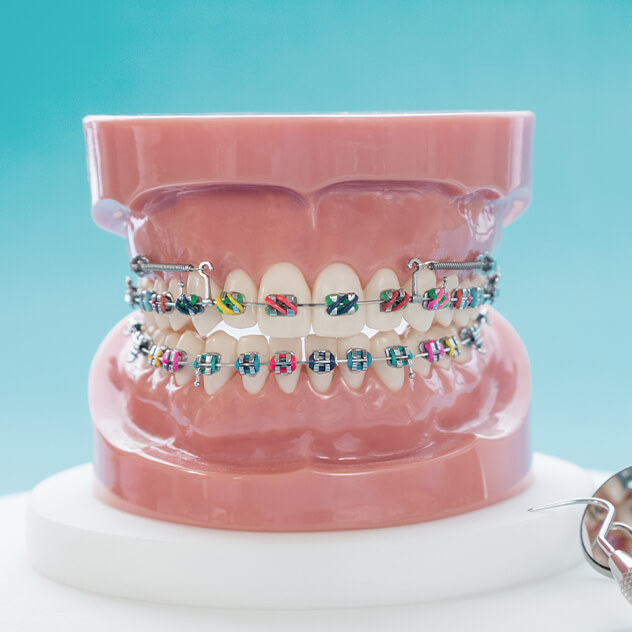 Braces