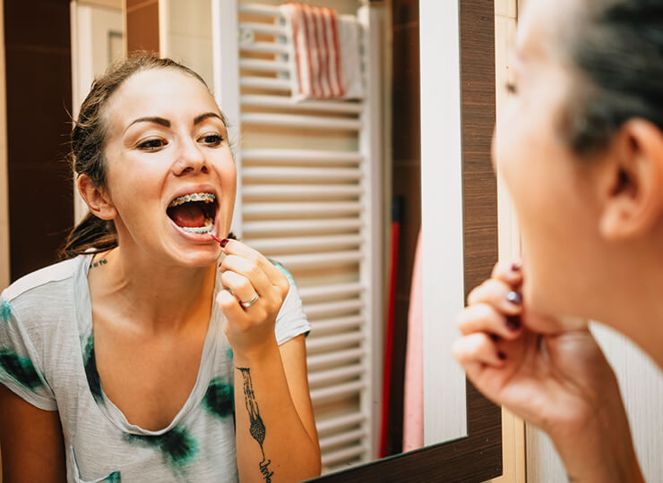 Caring for your braces 