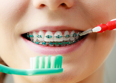Caring for your braces