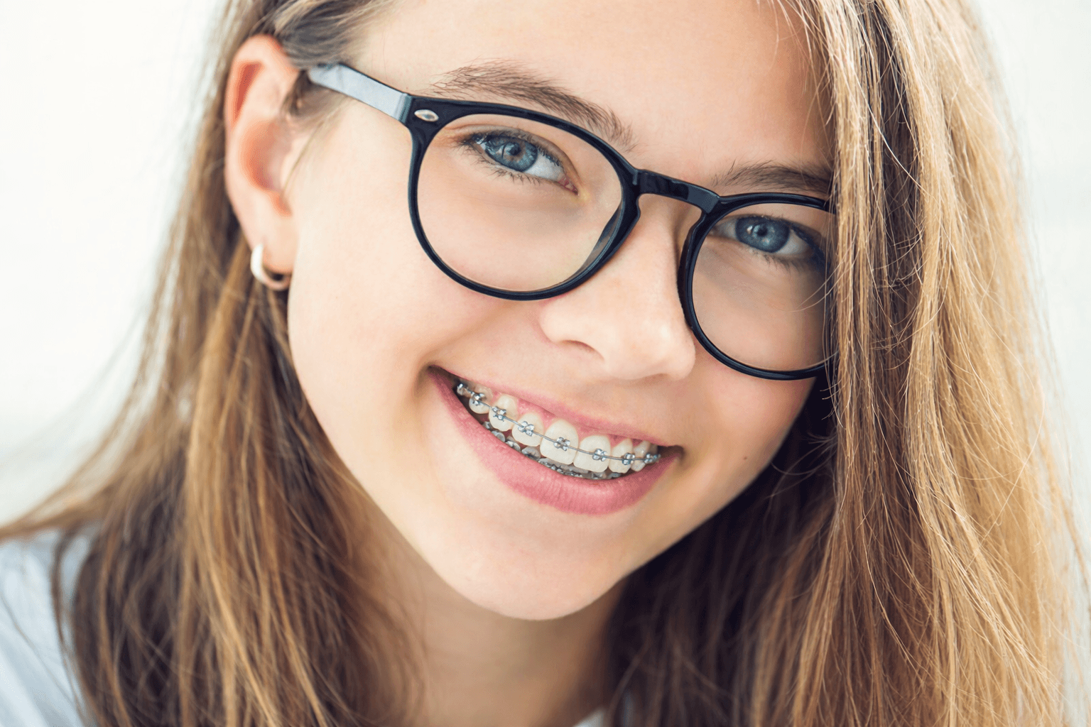 Braces