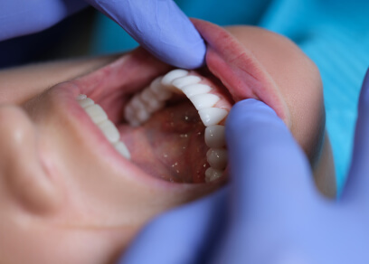 Jaw surgery