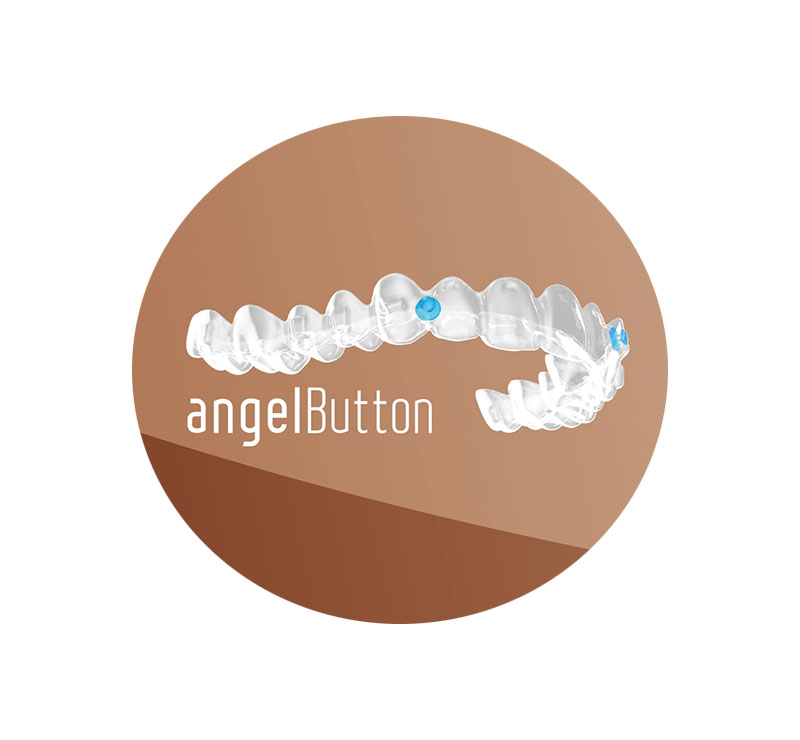 Benefits of Angel Aligners